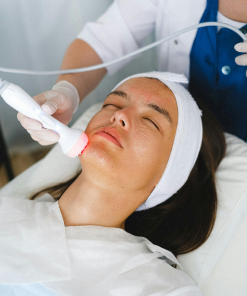 RF Anti Aging Facial